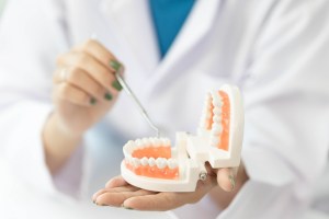 Un dentista sosteniendo una sonrisa dental protésica